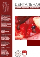 Остеотропные материалы в стоматологической практике