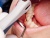 картинка Ланцет Paro - первичная пародонтальная терапия на аппаратах Vector Paro и Vector Paro Pro (Dürr Dental, Германия) от Алдент