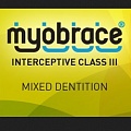 MYOBRACE FOR INTERCEPTIVE CLASS III для аномалий III класса от компании Алдент