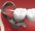 Кламп коффердам для моляров № DC1 (Dentech, Япония) Продажа стоматологического оборудования в Санкт-Петербурге